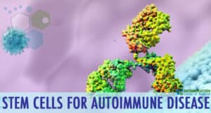 stemcell-therapy-autoimmune-diseases