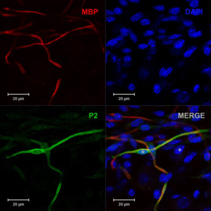 Crosstalk-between-peripheral-nervous-system-immune system