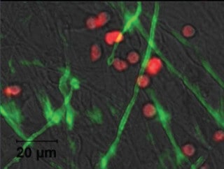 Schwann cells in focus: Understanding myelination and remyelination in the peripheral nervous system.