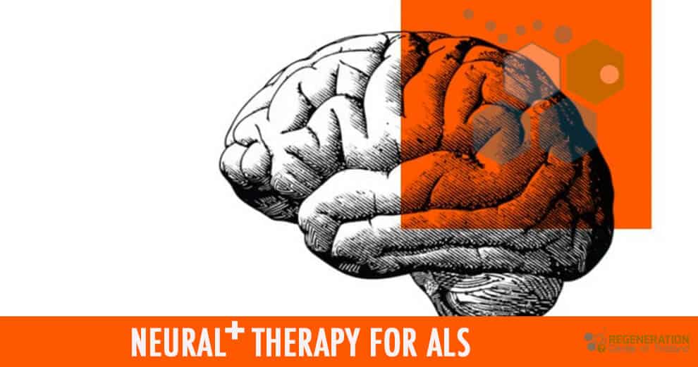 Targeted Neurogenic Stem Cell Therapy For Als Msc