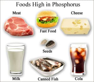 Phosphorus-Foods-KidneyDiet