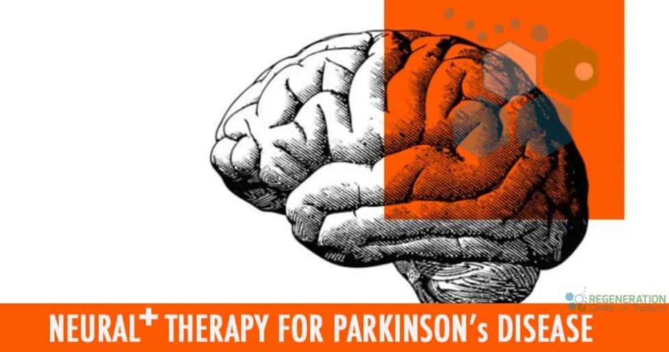 Parkinsons-StemCell-Therapy-2022