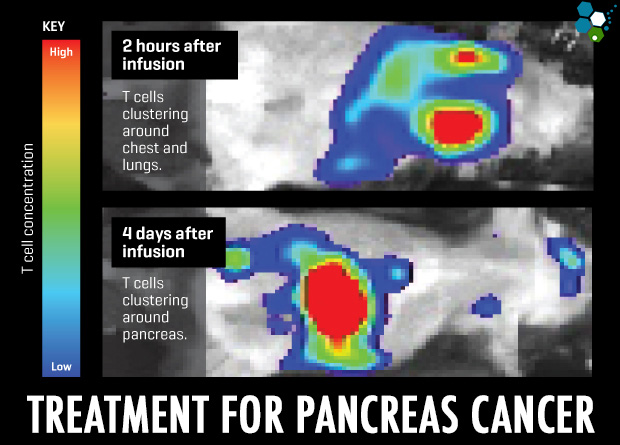 immunotherapy-pancreatic-cancer-stem-cells