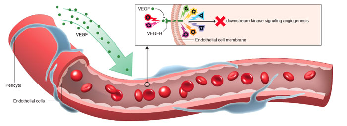 Angiogenesis-stem-cell-therapy