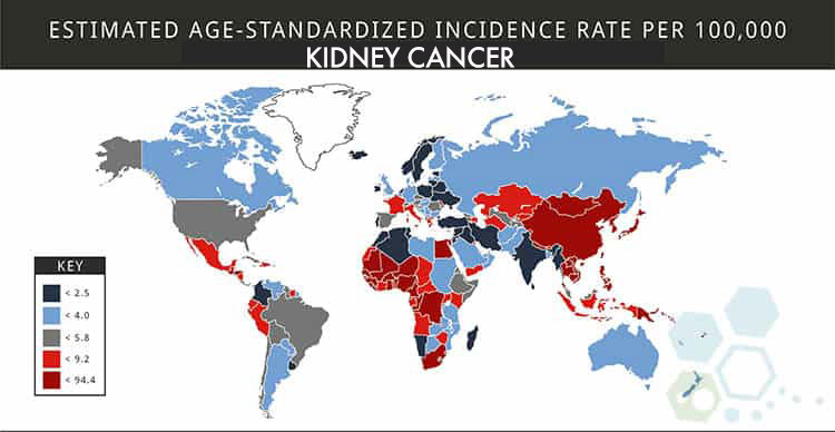 global-kidney-cancer-statistics