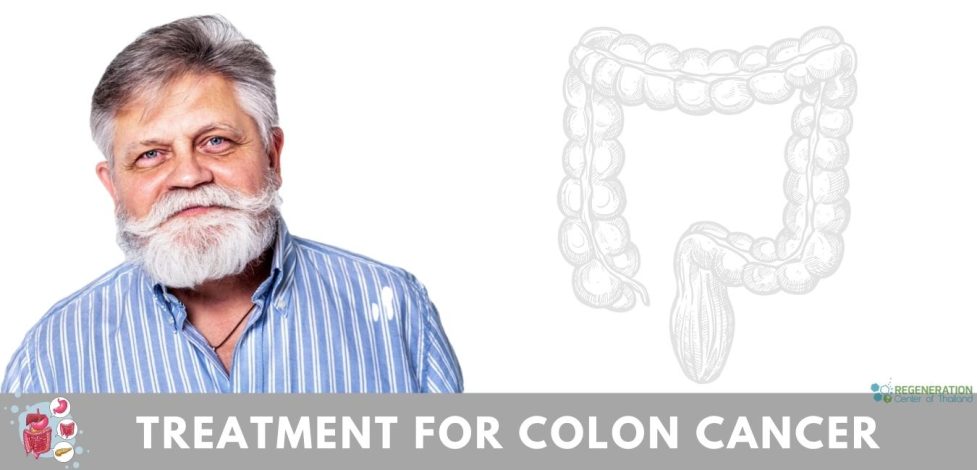 Treatment for Colon Cancer with Stem cell transplants