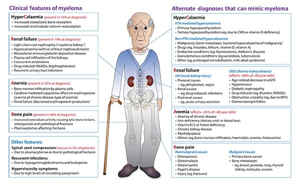 Kahler Disease Symptoms Offers | www.yakimankagbu.ru