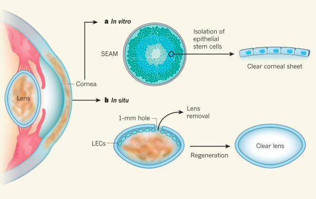 stem cell retina regeneration vision loss