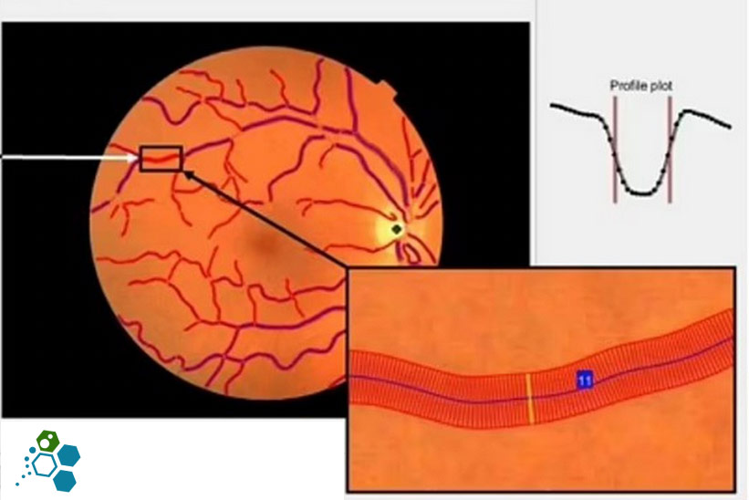 retina-vasculature-stemcells