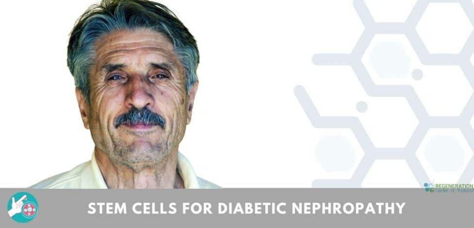Stem Cell Therapy for Diabetic Nephropathy