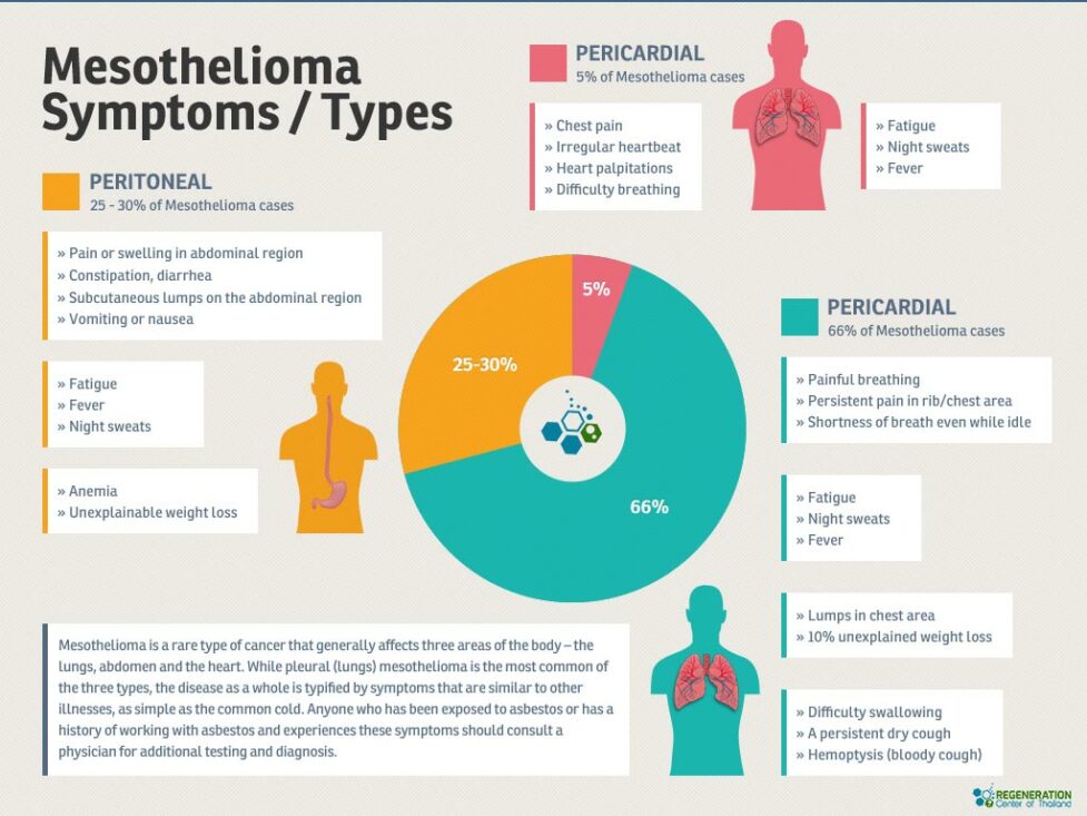 Immunotherapy & Stem Cells for Mesothelioma