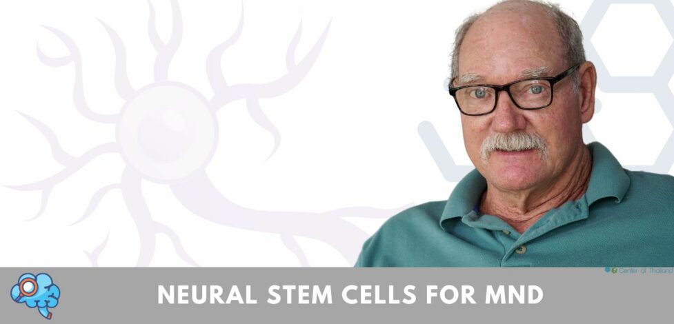 Stem cells treatment for MND