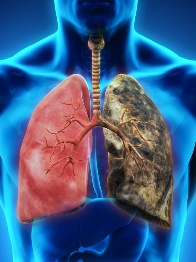 7 Deadly Health Risks & Respiratory Diseases Caused by Smoking
