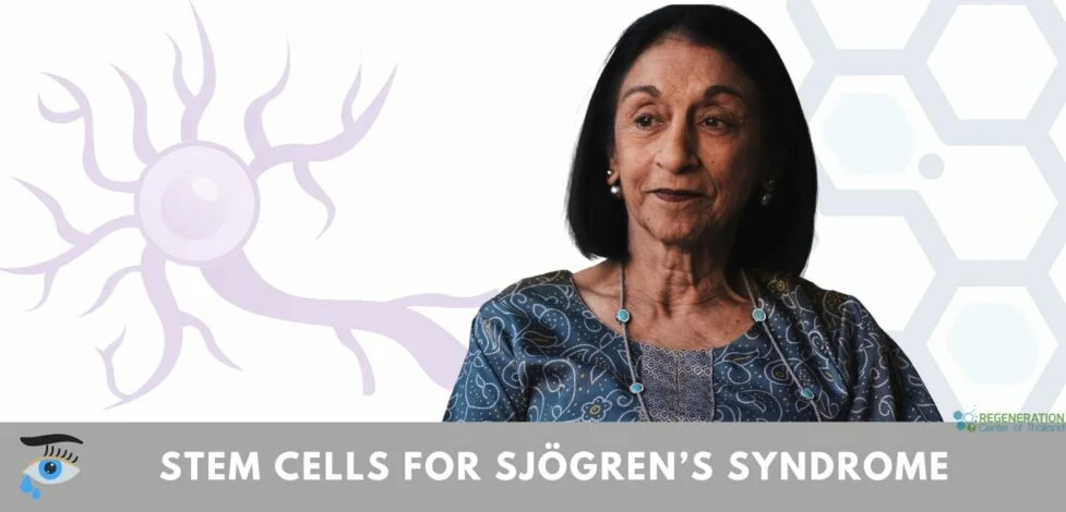 stem cell therapy for sjogren's syndrome