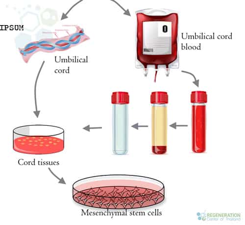 umbilical-cord-vs-peripheral-blood-MSC-stemcells
