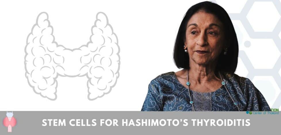 Stem Cell Treatment for Hashimoto’s thyroiditis