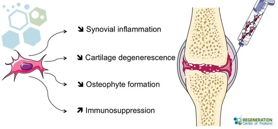 Immunomodulatory Effects of Stem Cells for Rheumatoid Arthritis