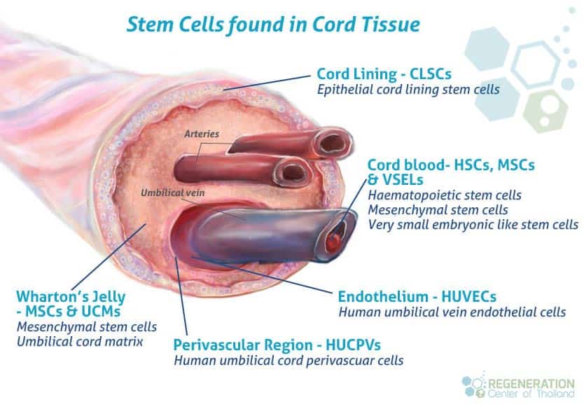 Wharton’s jelly mesenchymal stem cells (WJ-MSCs)
