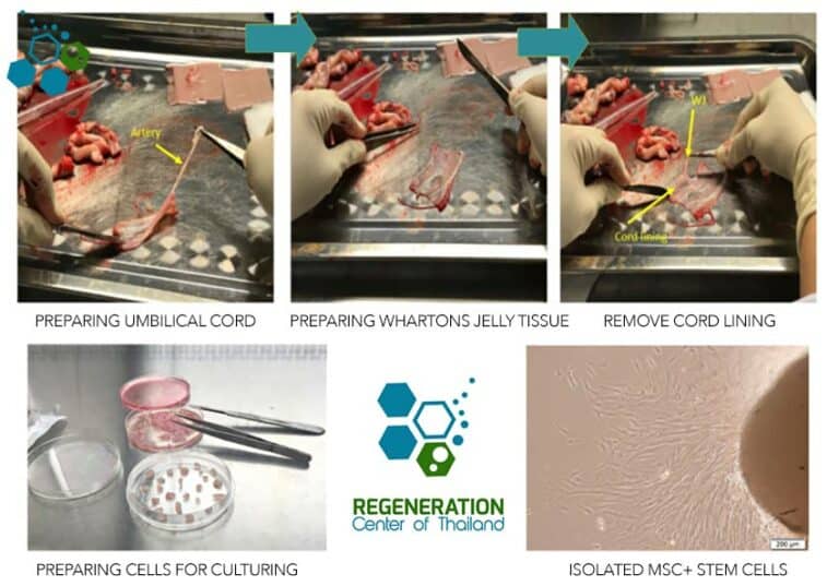 Whartons Jelly Mesenchymal Stem Cells Wj Mscs