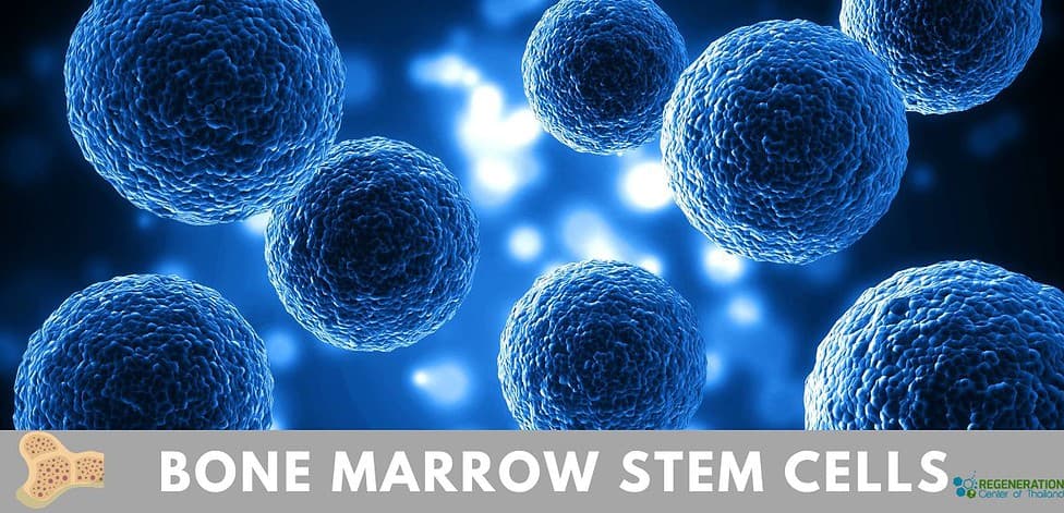 Bone Marrow Stem cell Transplants