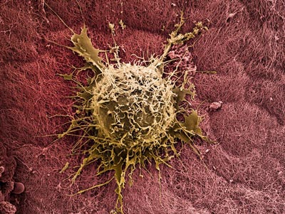 bone-marrow-stem-cell-therapy