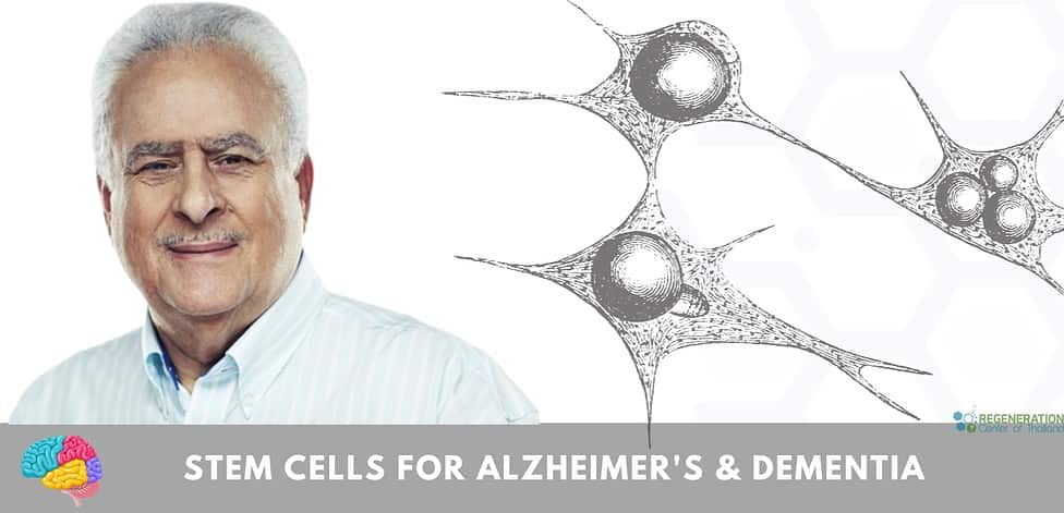 Stem Cells for alzheimer's & dementia
