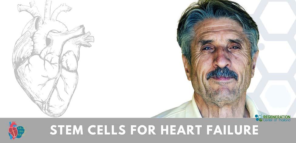 Cost of Stem Cell Treatment For Heart Failure