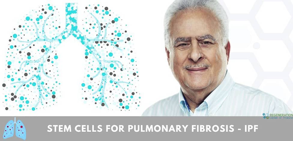 Stem Cell Therapy for IPF - Pulmonary Fibrosis - bronchiectasis