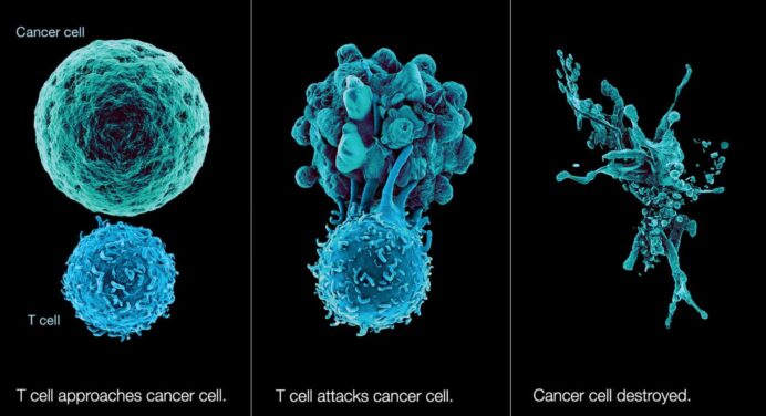 NK Cell Therapy Explained: Next Generation Cancer Treatments