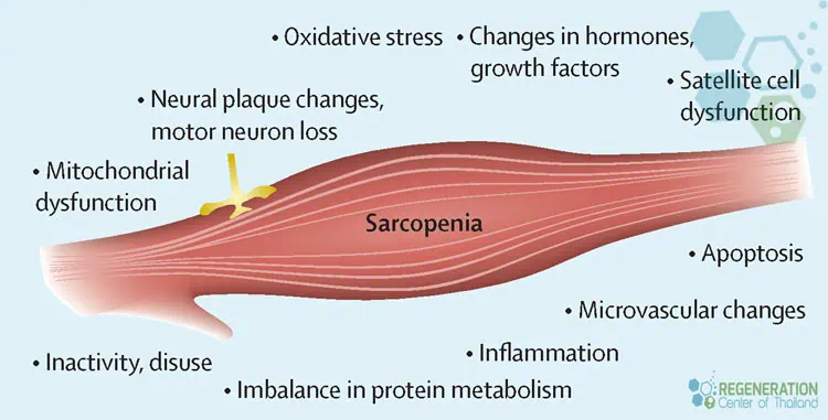 reverse-Sarcopenia