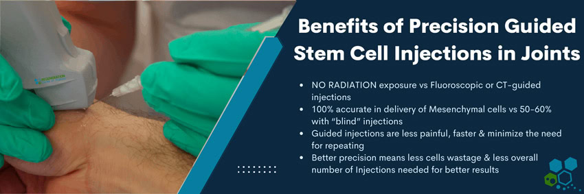 Ultrasound-guided-stem-cell-injections-hand-Joints-wrist-arthritis
