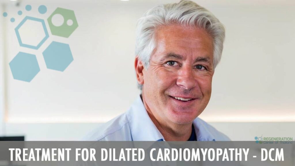 stem-cell-treatment-dilated-cardiomyopathy