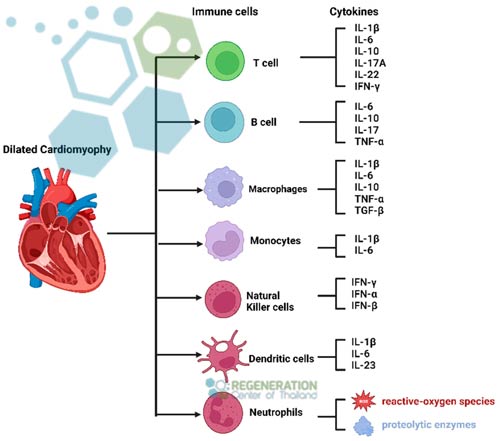 stem-cell-treatment-for-dilated-cardiomyopathy