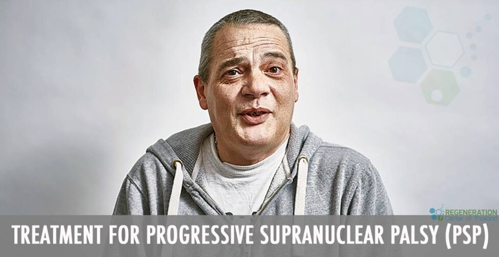 STEMCELL-TREATMENT-PROGRESSIVE-SUPRANUCLEAR-PALSY-PSP