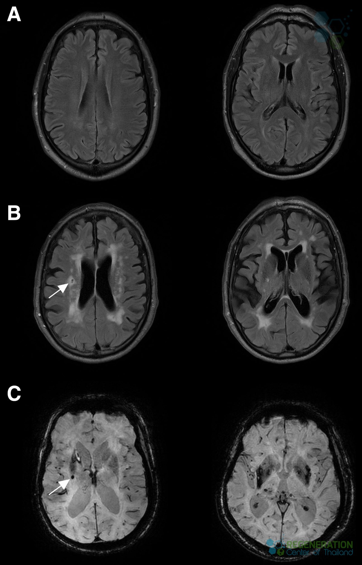Diagnostic MRI images used during a coordinated clinical review