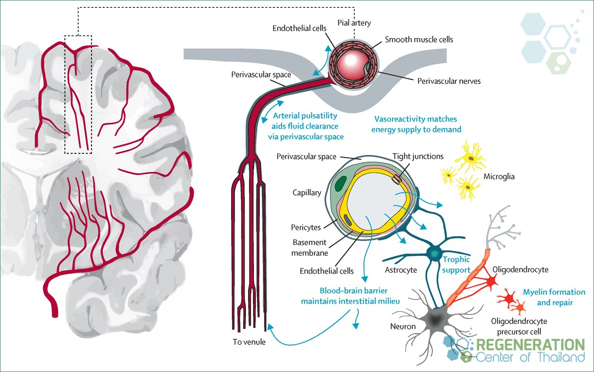 stem-cell-therapy-cerebral-small-vessel-disease-neurovascular-repair