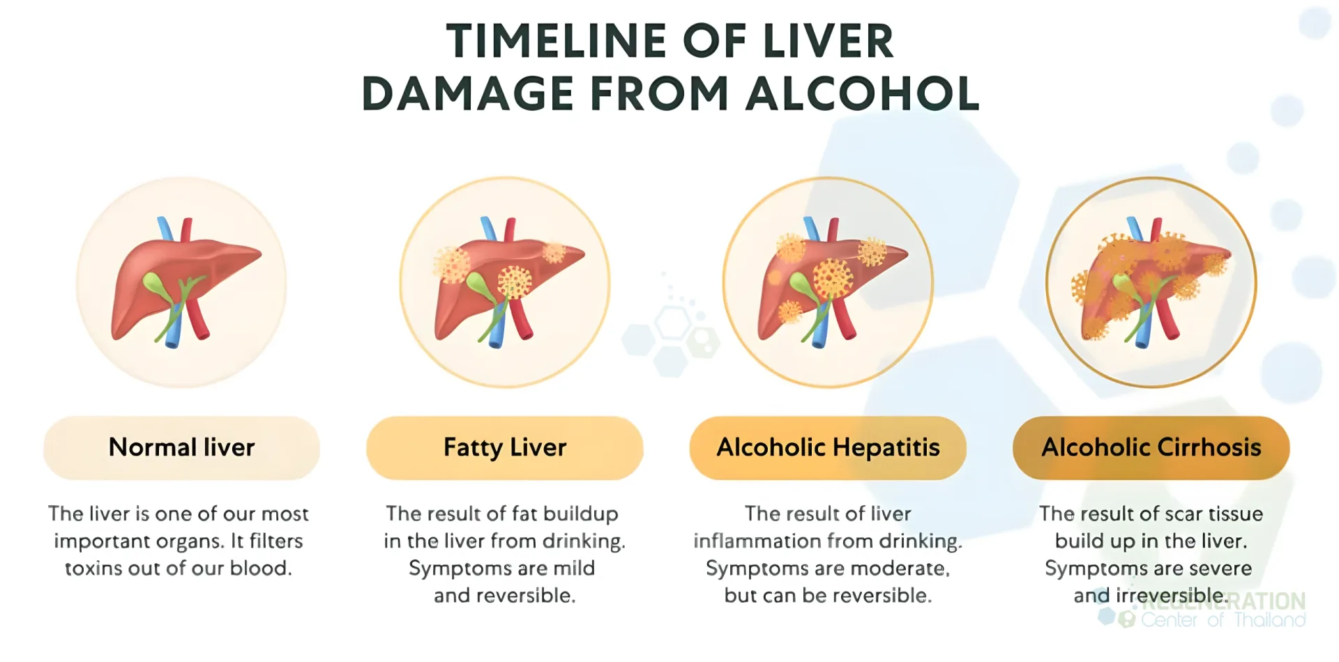 Enhanced visual alternative for Alcoholic-liver-disease-stem-cells – media repair