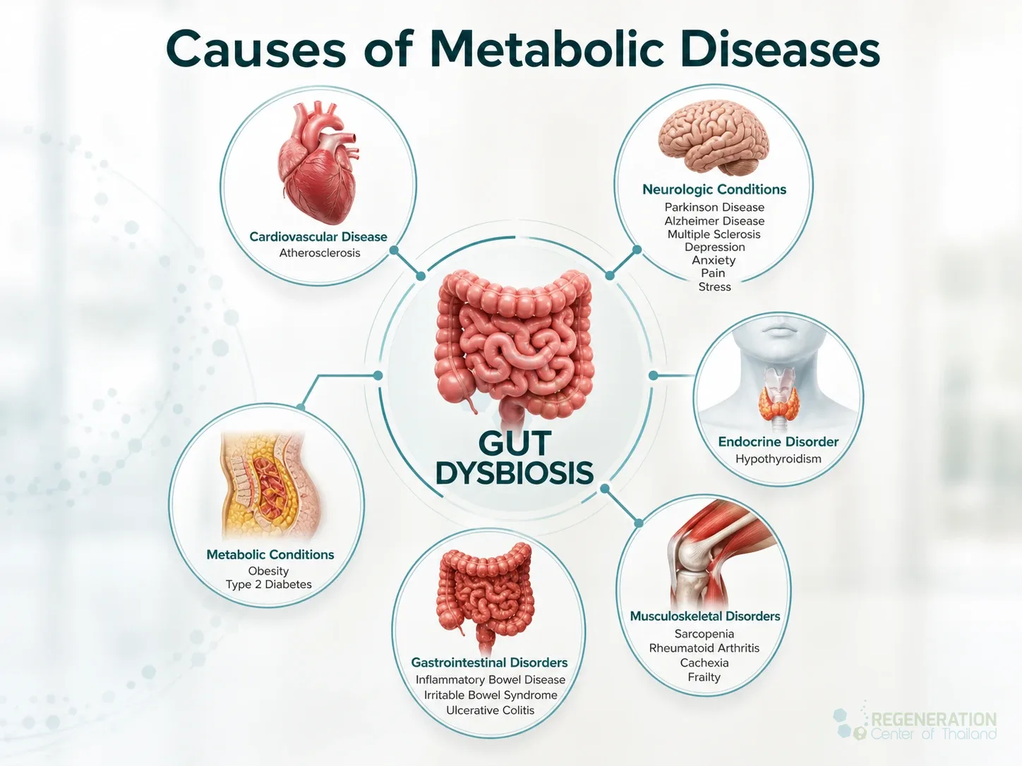 Diagram linking gut dysbiosis with cardiovascular, neurologic, endocrine, musculoskeletal and gastrointestinal conditions for Causes, Symptoms & Stem Cell Treatment for Metabolic Diseases.
