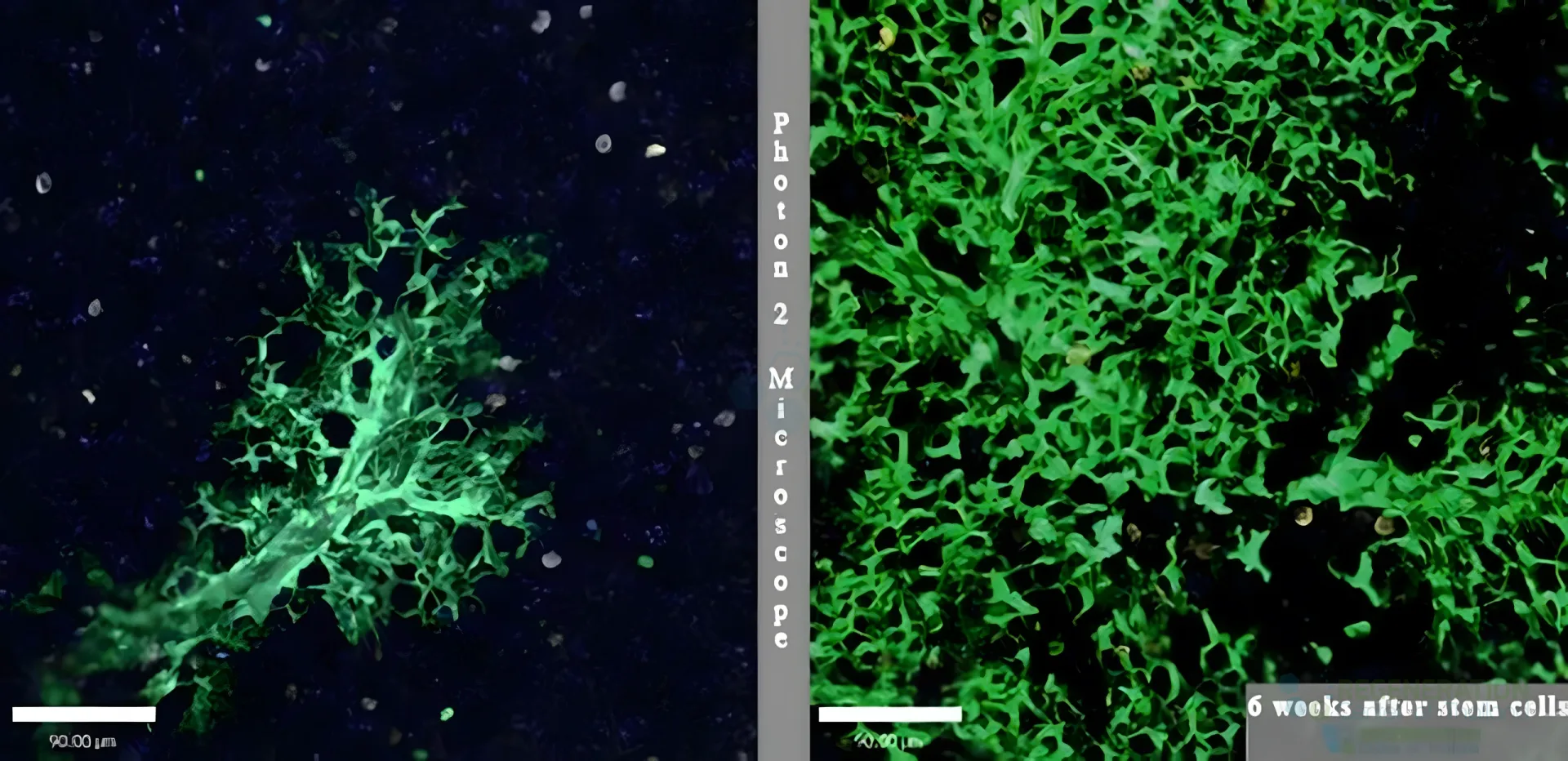 Fluorescence microscopy comparison of lung tissue before and six weeks after stem cell treatment
