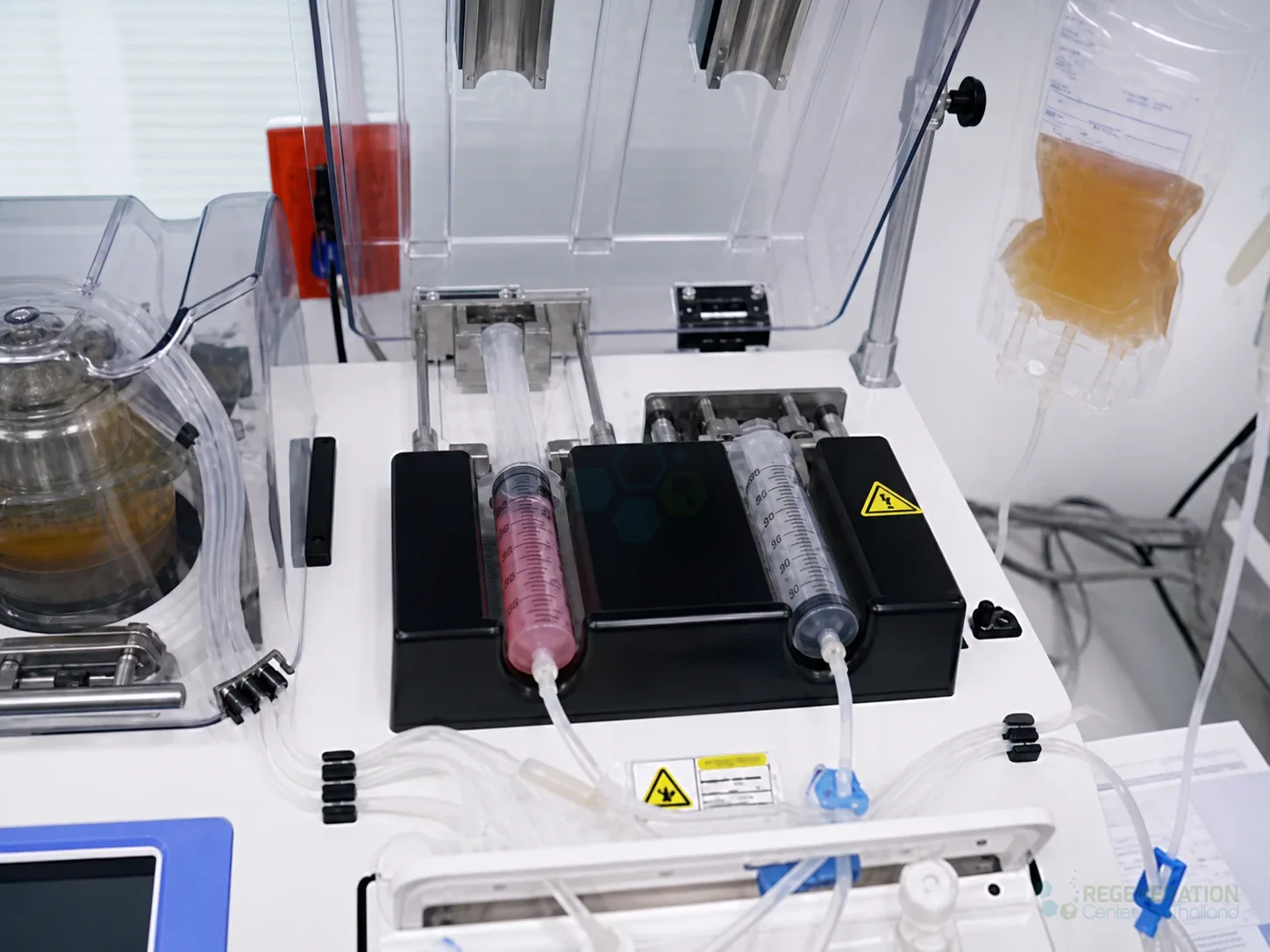 copd therapy stem cells thailand for Exogenous Stem Cell Therapy for COPD & Emphysema