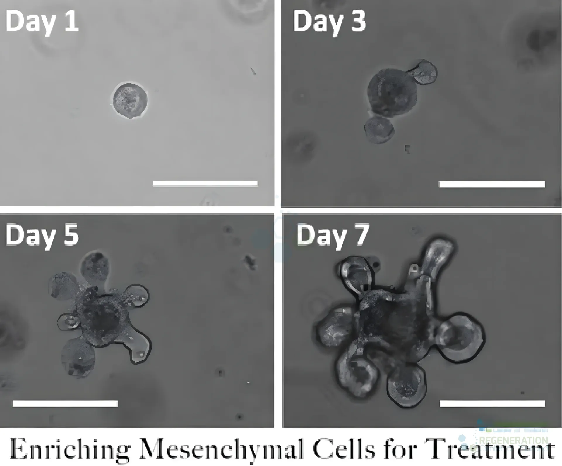 for expanding mesenchymal stem cell transplants – media repair