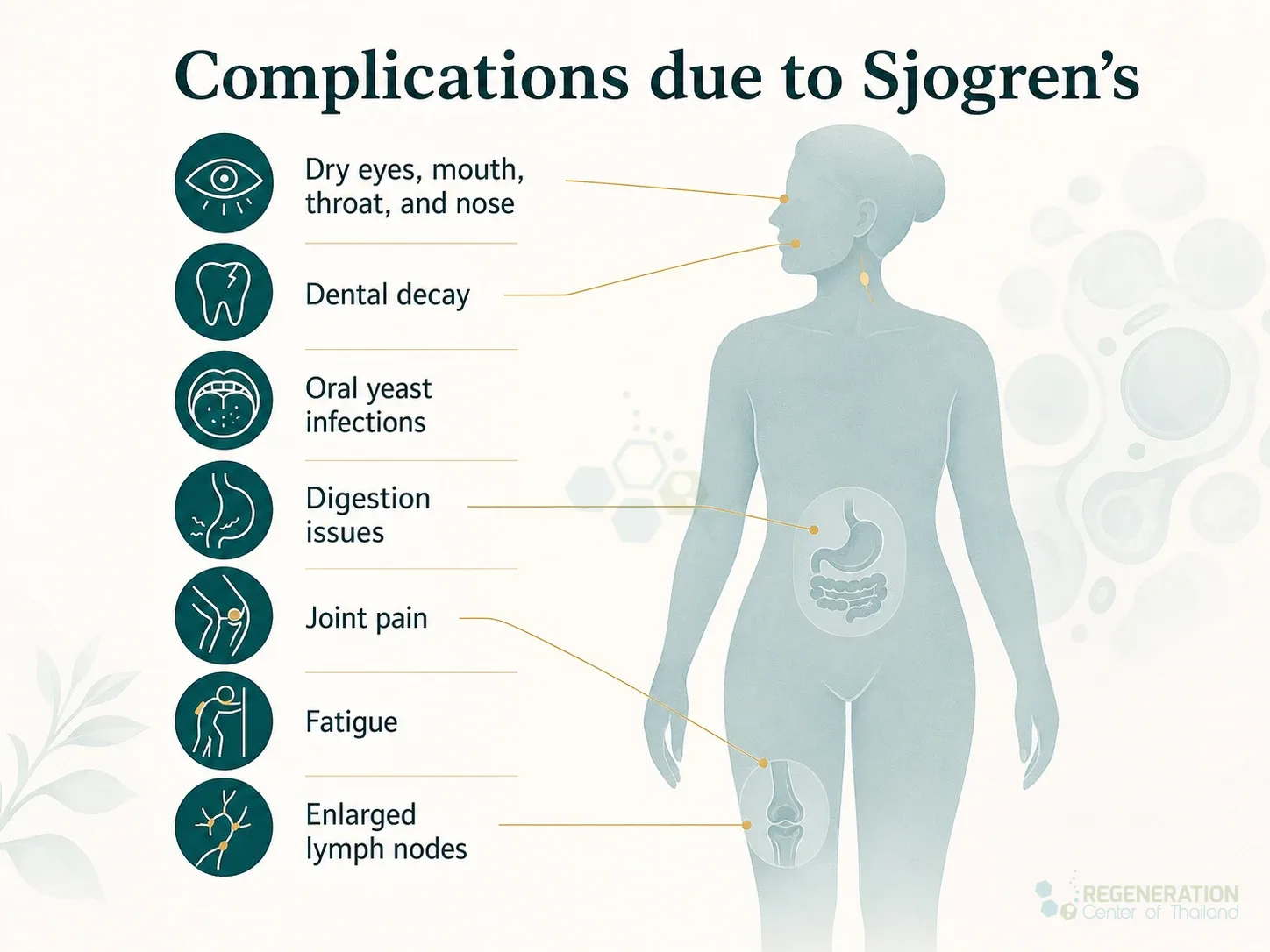 Infographic listing common symptoms of Sjogren's syndrome for Isolated UC-MSC+ Stem Cell Treatment for Sjogren’s Syndrome.