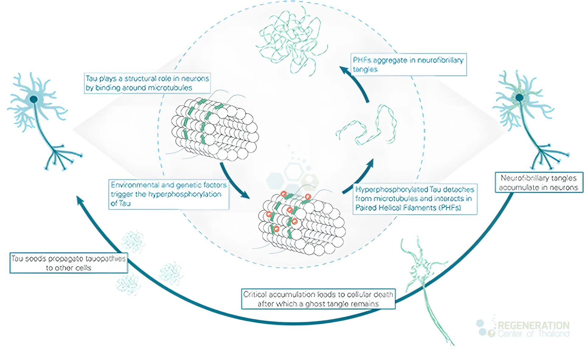 Double-prion-Disorders-alzheimers for Neural Stem Cell Therapy for Alzheimer’s, Vascular & Lewy body.