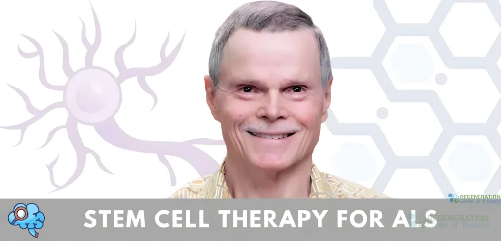 Enhanced visual alternative for stemcell-treatment-ALS-neural-cells