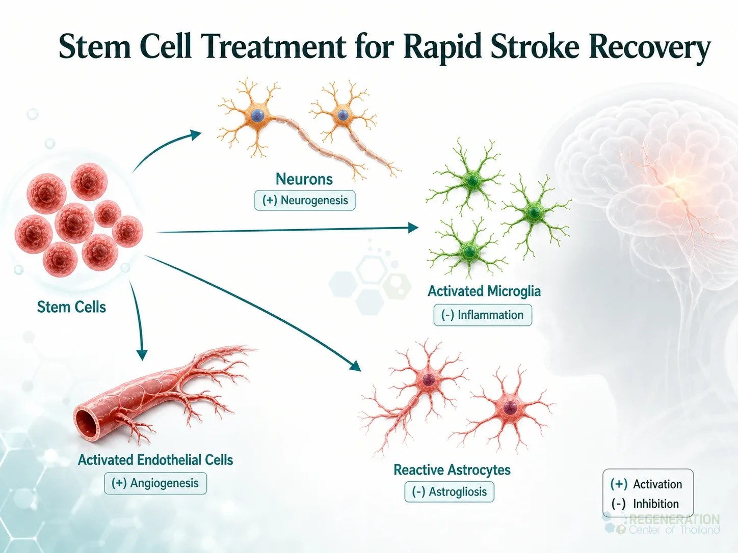 stem cell treatment for stroke results for Neurogenic Stem Cell Treatment For Stroke Recovery.