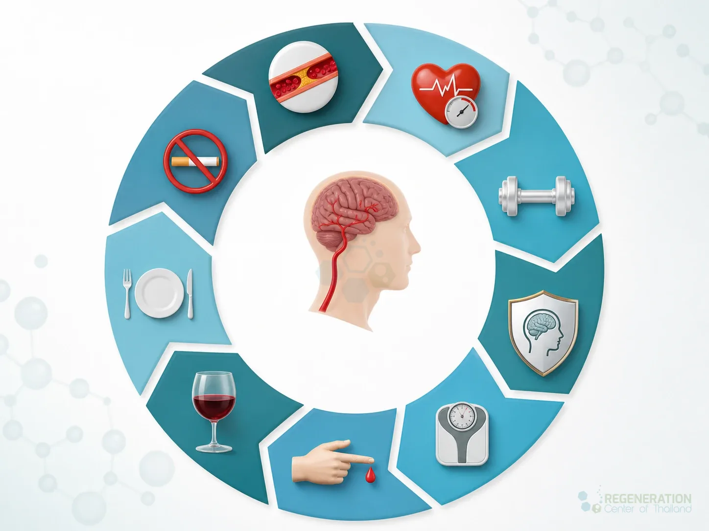 how-to-prevent-strokes for Neurogenic Stem Cell Treatment For Stroke Recovery.