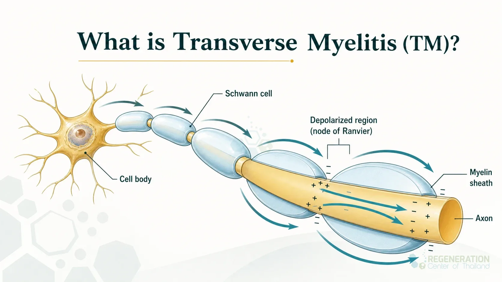 Diagram showing anatomy and signal conduction along a myelinated axon for Spine Inflammation & Stem Cell Therapy for Transverse Myelitis.