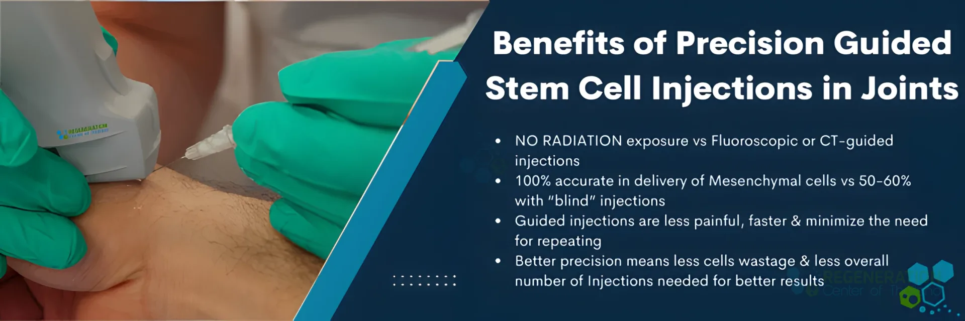 Ultrasound-guided-stem-cell-injections-hand-Joints-wrist-arthritis for Stem Cell Therapy for Hand Injuries & Wrist Arthritis.
