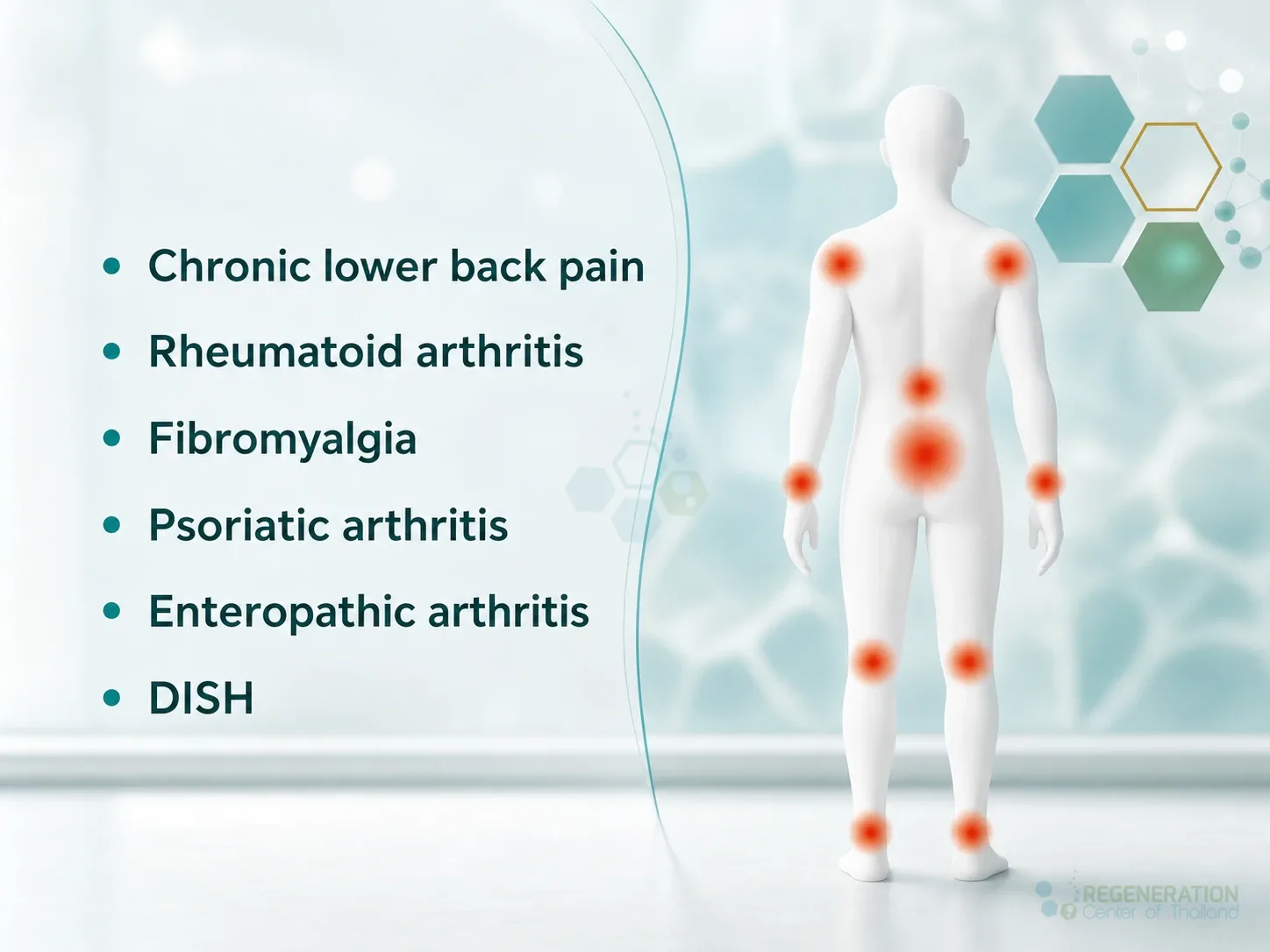 Infographic listing conditions that can resemble ankylosing spondylitis for Stem Cell Treatment for Ankylosing Spondylitis – AS