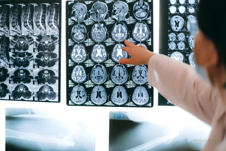 Enhanced visual alternative for Radiologist pointing at brain MRI scans showing detailed medical examination.
